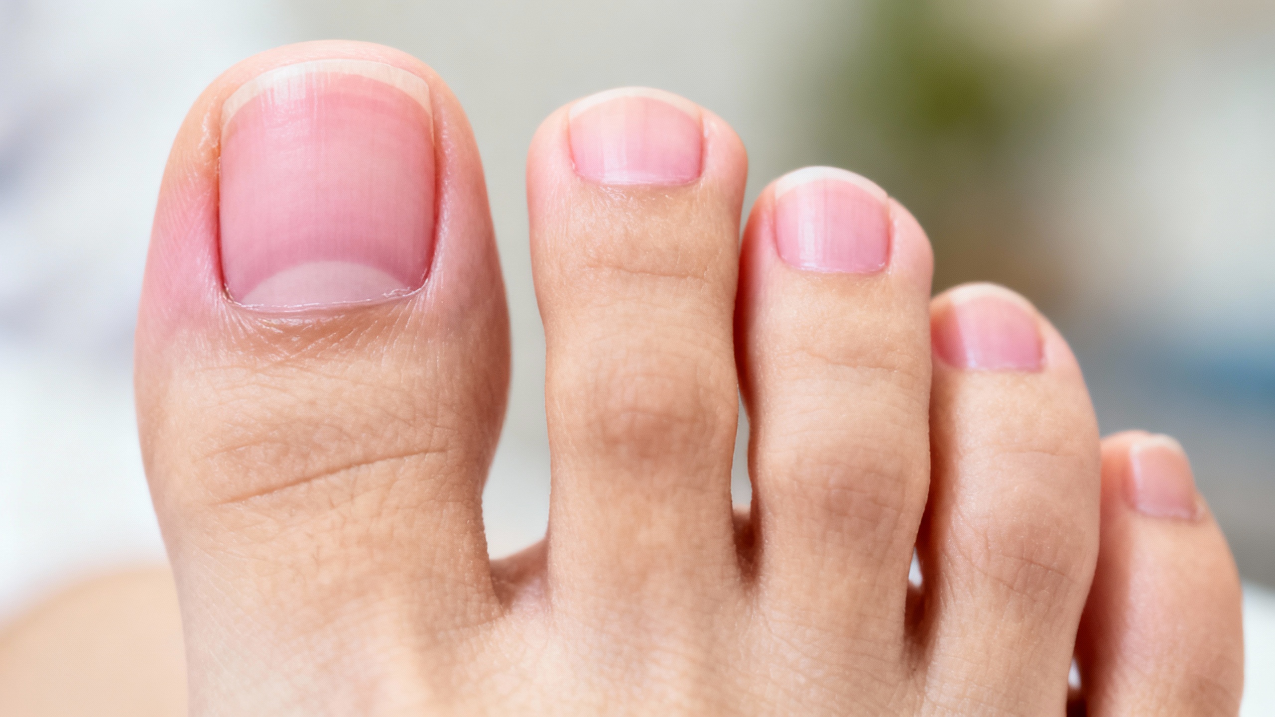 Your guide to healthier toenails